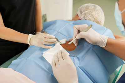 Doctor and assistant working together during a Mohs surgical procedure to treat skin cancer.